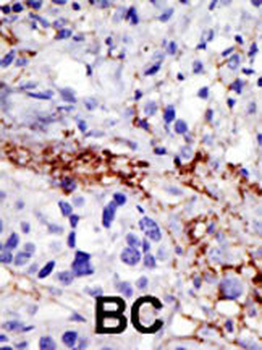USP21 Antibody (C-term)