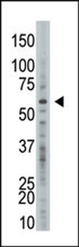 USP21 Antibody (C-term)
