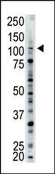USP15 Antibody (N-term)