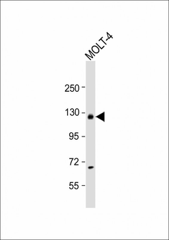 USP15 Antibody (N-term)