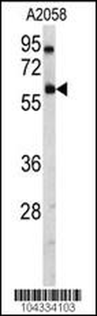 USP14 Antibody (N-term)