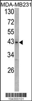 USP12 Antibody (C-term)