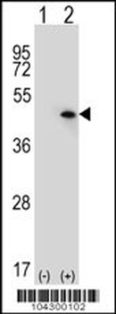 USP12 Antibody (C-term)