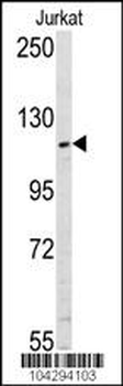 USP11 Antibody (N-term N20)