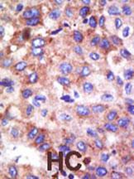 UBE2G1 Antibody (N-term)