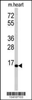 UBE2G1 Antibody (N-term)