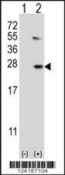 UBE2G1 Antibody (N-term)