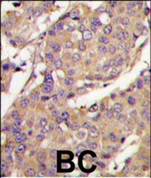 UBE2L6 Antibody (C-term)