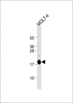 UBE2L6 Antibody (C-term)