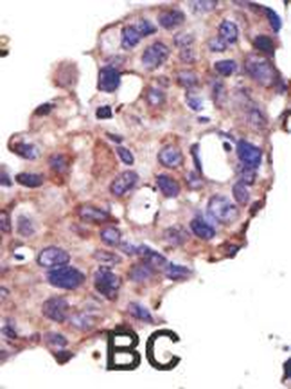 UBE2L3 Antibody (C-term)