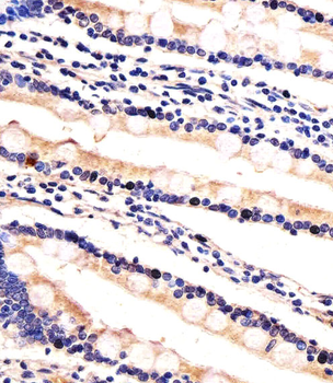 HIP2 Antibody (Center)