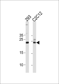 HIP2 Antibody (Center)