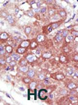 UBE2D1 Antibody (C-term)
