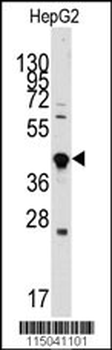 GDF3 Antibody (Center)