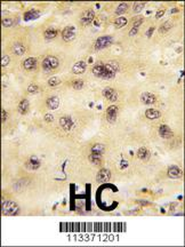 PROX1 Antibody (Center)