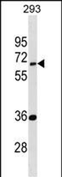 EDC3 Antibody (Center)