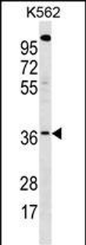 WBSCR22 Antibody (C-term)