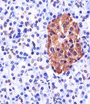 Neurogenin3 Antibody (N-term)