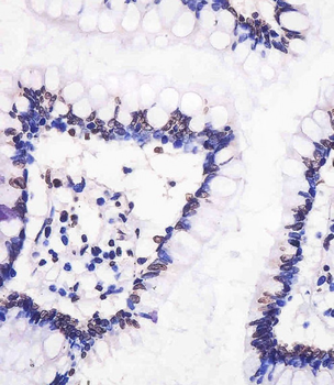 Neurogenin3 Antibody (N-term)