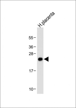 Neurogenin3 Antibody (N-term)