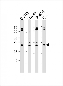 Neurogenin3 Antibody (N-term)