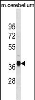 Mouse Ublcp1 Antibody (Center)