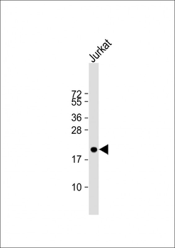 APOBEC3A Antibody (N-term)