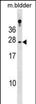 RBP4 Antibody (N-term)