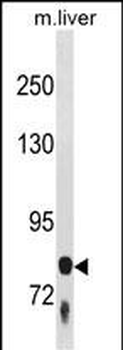 F13B Antibody (N-term)