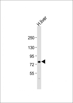 F13B Antibody (N-term)