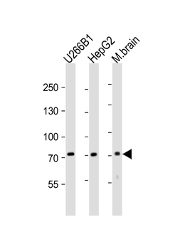 CD73 (NT5E) Antibody (C-term)