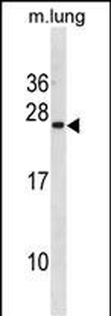 ISCU Antibody (C-term)