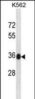 MMACHC Antibody (C-term)