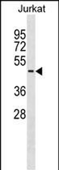 SERPINB8 Antibody (C-term)