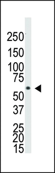 BMPR1A Antibody (N-term)