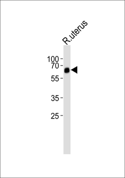 BMPR1A Antibody (N-term)