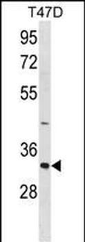 HAVCR2 Antibody (Center)