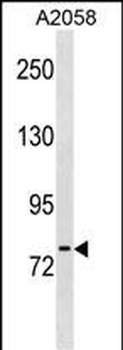 NLN Antibody (Center)