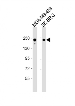 ERBB2 Antibody (C-term S1050/S1051)
