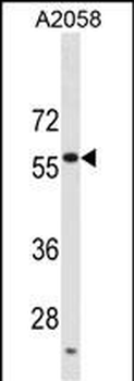 USP14 Antibody (C-term)