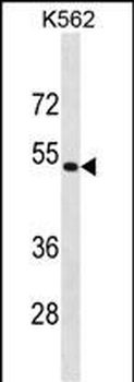 PSMD4 Antibody (C-term)