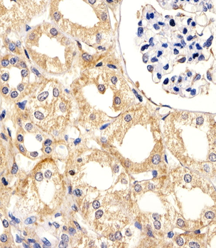 UBE2L3 Antibody (C-term)