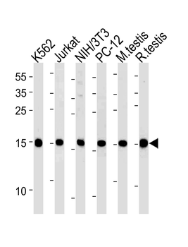 UBE2L3 Antibody (C-term)