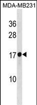 RPL30 Antibody(N-term)