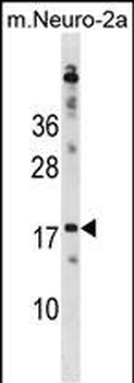 RPL30 Antibody(N-term)