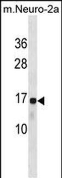 RPL22 Antibody(C-term)