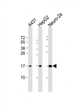 RPL22 Antibody(C-term)
