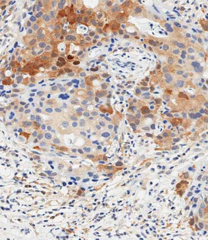 STAT1 Antibody (C-term)