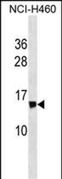 NDUFS6 Antibody (Center)
