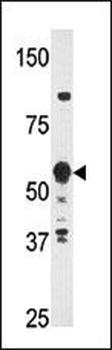 HDBP2(HDRF-2) Antibody (Center)